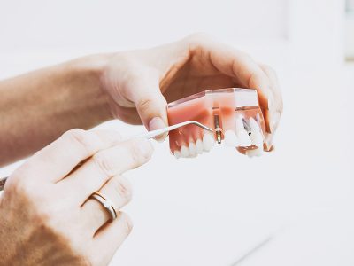 Reliabilität und Übereinstimmungsmaße in der Zahnheilkunde und Kieferorthopädie